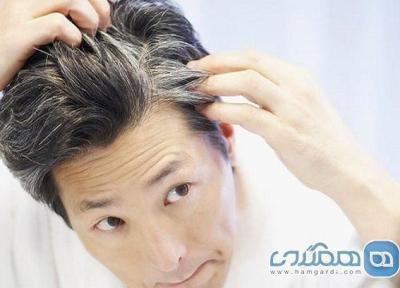 کندن موهای سفید باعث زیاد شدن آنها می شود؟